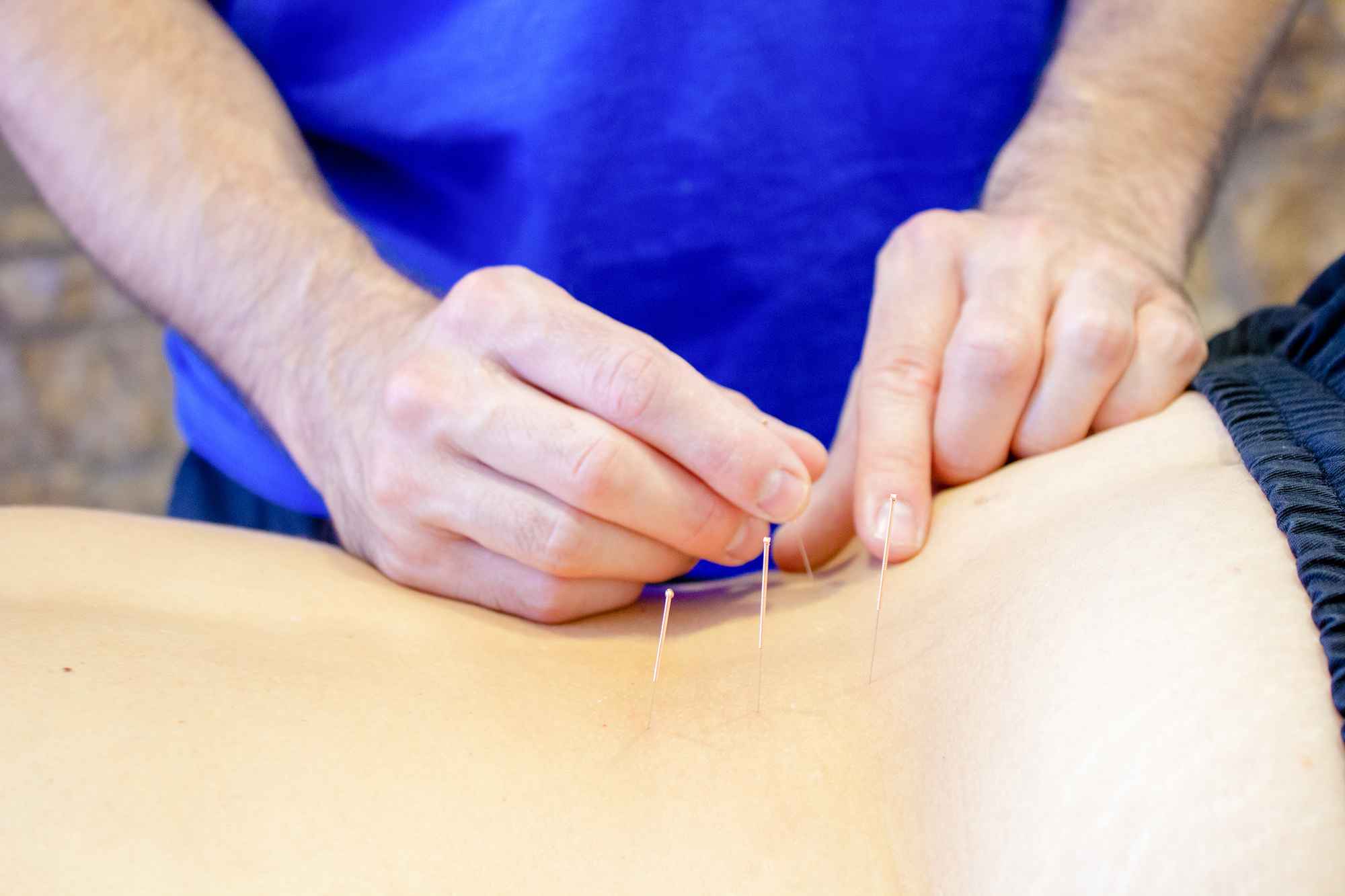 Medicina tradicional china. Sendai centro de fisioterapia - osteopatía en Donostia